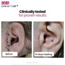 cica-glocalcare-clinical-grade-skin-reco-6.jpg
