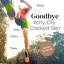 puriya-wonder-balm-extra-strength-itch-r-5.jpg
