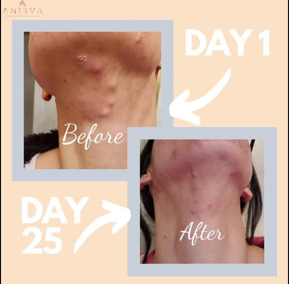 clear-skin-supplement-with-zinc-probioti-3.jpg