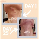 clear-skin-supplement-with-zinc-probioti-3.jpg