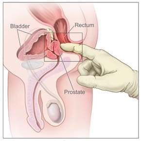 pulean-formula-natural-enlarged-prostate-3.jpg