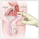 pulean-formula-natural-enlarged-prostate-3.jpg
