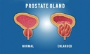 pulean-formula-natural-enlarged-prostate-4.jpg