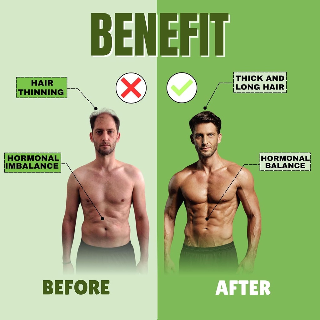 saw-palmetto-prostate-support-extra-stre-2.jpg