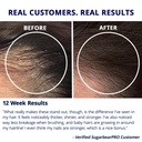 sugarbear-hair-vitamin-gummy-2-month-sup-5.jpg