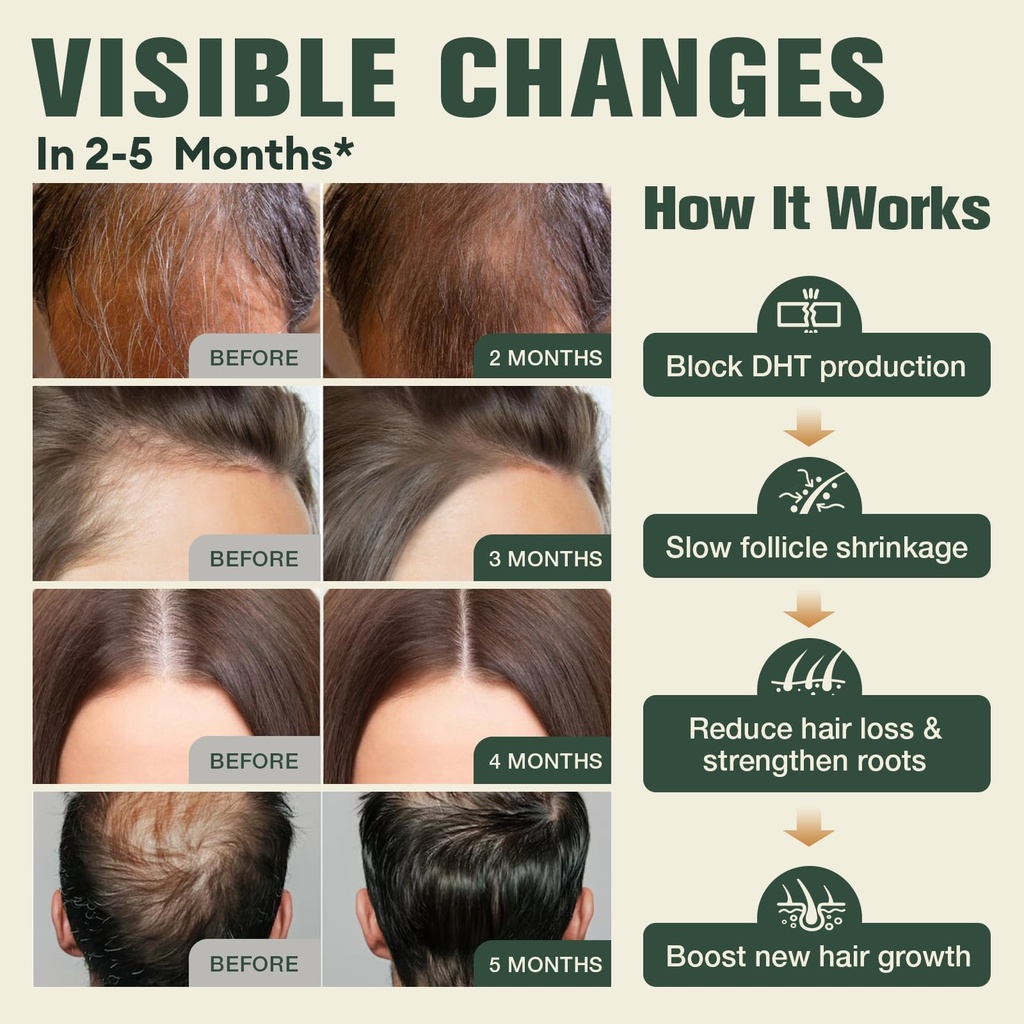 dht-blocker-for-men-women-27-in-1-hair-g-6.jpg