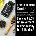 probiotics-for-hair-growth-biotin-10000m-4.jpg