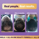 herbtonics-foli-biotin-gummies-with-hair-4.jpg