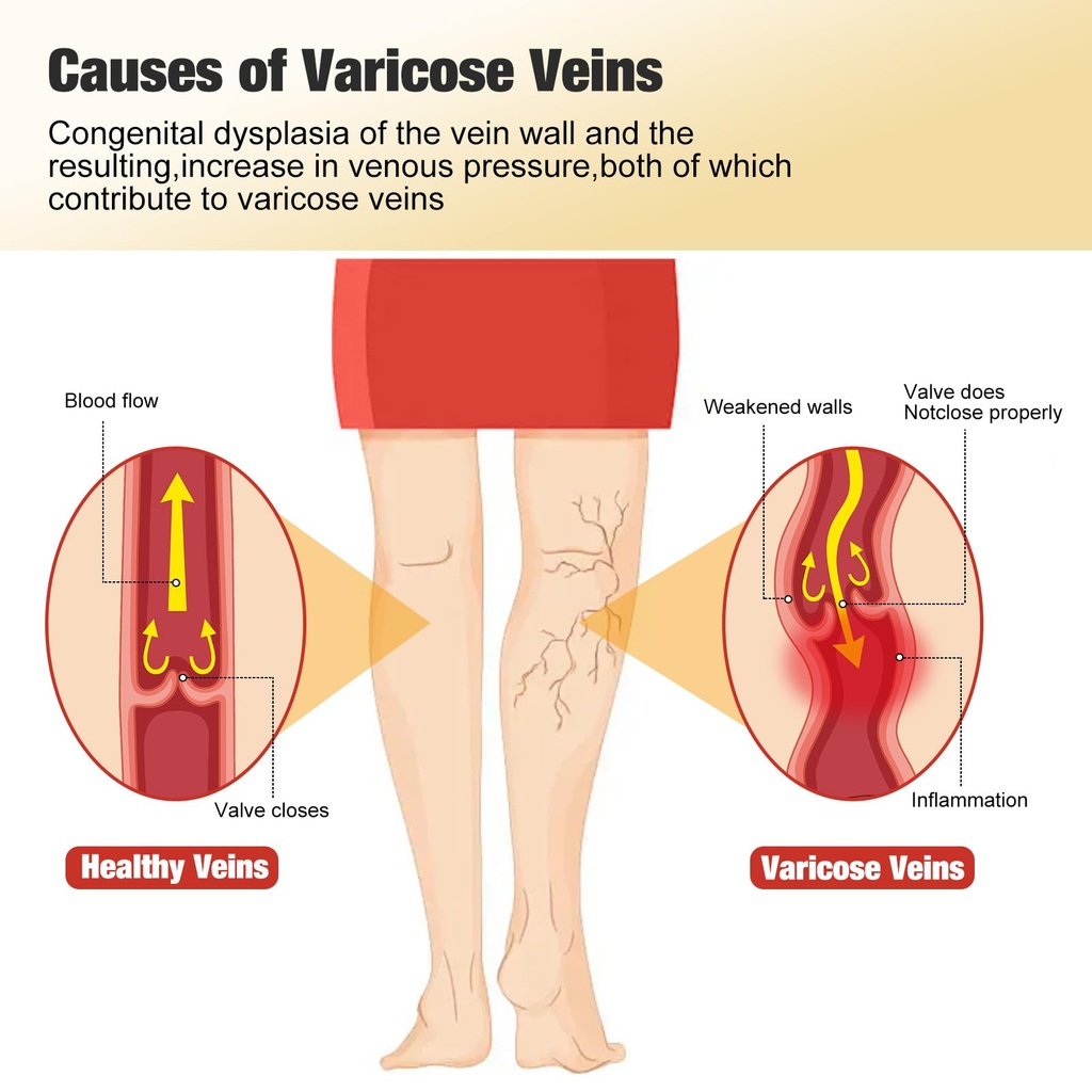 36pcs-varicose-veins-patch-turmeric-vari-5.jpg
