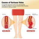 36pcs-varicose-veins-patch-turmeric-vari-5.jpg