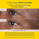 ritual-hyaluronic-acid-skin-supplement-w-5.jpg