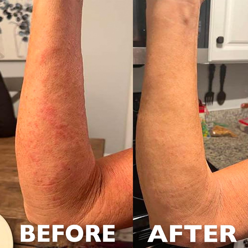 hey-honey-skincare-911-multipurpose-heal-4.jpg