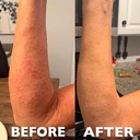 hey-honey-skincare-911-multipurpose-heal-4.jpg