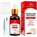 Toe Nail Fungus behandlinger for tåneil: Nail Fungus behandling for fingernegler – ekstra styrke, rask-virkende løsning for brakket, skadet, misfarget negler