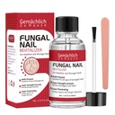 Toenail Fungus Treatment Extra Strength, Nail Fungus Treatment with Undecylenic Acid for Toenail & Fingernails, Antifungal Nail Repair for Athletes Foot, Ingrown, Thick, Broken, Damaged Nail, 30ml
