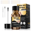 Toenail Fungus Treatment,Foot Fungus Treatment Extra Strength,Fungus Nail Treatment, Toe Nail Fungus Treatments For Fungi Nail yellow toenail treatment(1fl oz/30ml)