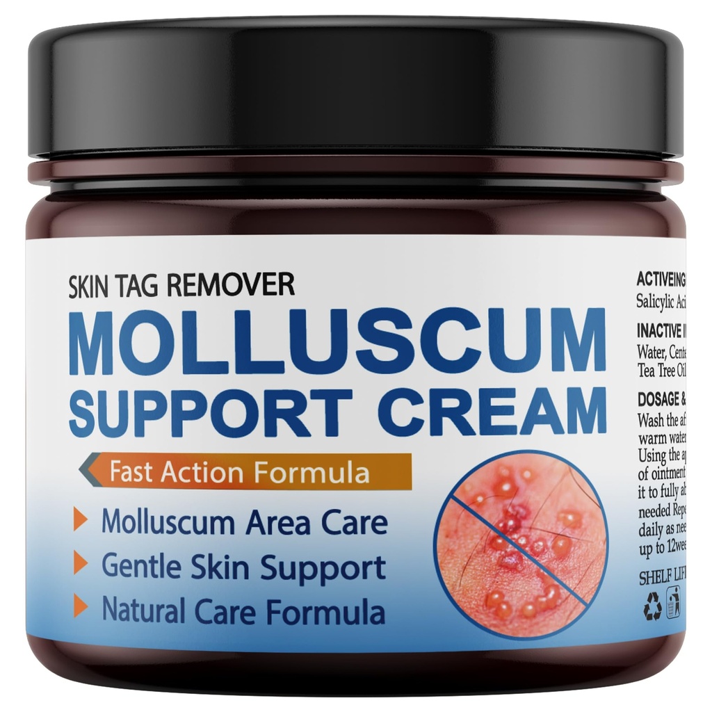 Molluscum Support Treatment, Molluscum Support Cream All Natural Support Cream for Molluscum Rash, 30g