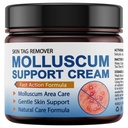 Molluscum Support Treatment, Molluscum Support Cream All Natural Support Cream for Molluscum Rash, 30g