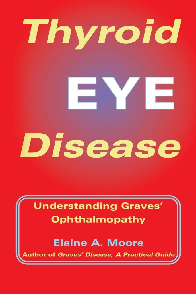 Thyroid Eye Disease: Understanding Graves' Ophthalmopathy