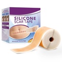 Silicone Scar Tape Roll, 1.6” x 60” Medical Tape for Wound Care Bandages Scars Strips for Surgical Scars Keloid, C-Section, Burns, Injuries Acne, Stretch Marks Removal Sheet Tapes (1.6” x 60”)