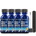 Toenail Fungus Treatment Extra Strength with 25% Undecylenic Acid & Tea Tree Oil - Antifungal Nail Treatment for Damaged Nails and Thick Toenails (2 Fl Oz)