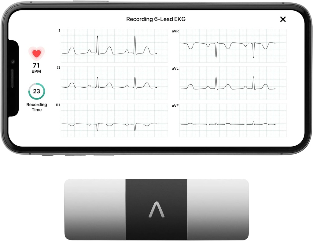 AliveCor KardiaMobile 6-Lead Personal EKG монітор – Шість переглядів серця – Виявлення AFib та нерегулярних аритмій – Миттєві результати в 30 секунд – роботи з більшістю смартфонів