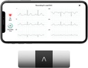 AliveCor KardiaMoniteur EKG personnel 6-Lead – Six Vues du Coeur – Détecte AFib et les arythmies irrégulières – Résultats instantanés en 30 secondes – Fonctionne avec la plupart des smartphones