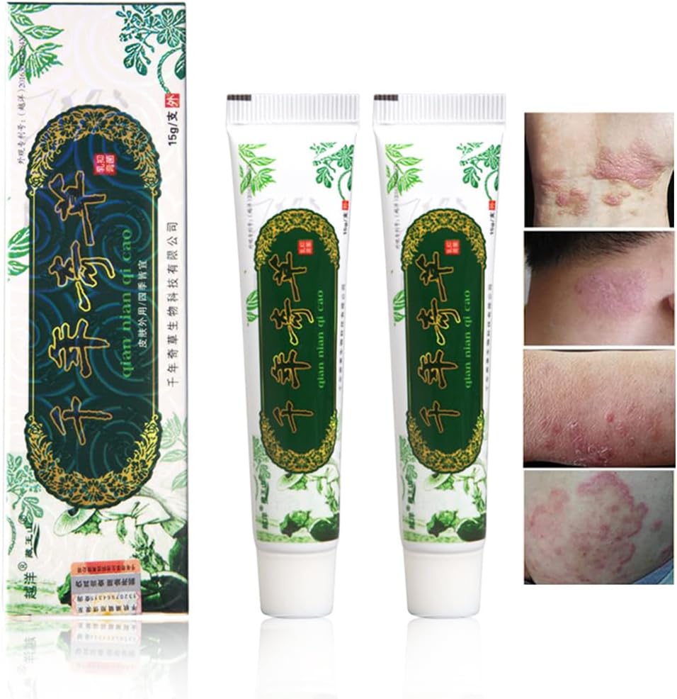 Oversea Mii de ani Herbal Cream Chinez Eczema, Psoriazis Crems Dermatită şi Eczemă Prurit Psoriazis JIULIN Ointment (2CPS)