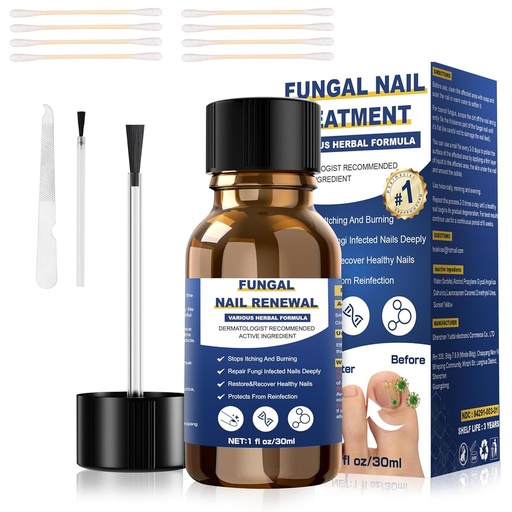 [BRSRAGQCBMGQMDT3] Toenail Fungus Treatment,Foot Fungus Treatment Extra Strength,Fungus Nail Treatment, Toe Nail Fungus Treatments For Fungi Nail yellow toenail treatment(1fl oz/30ml)