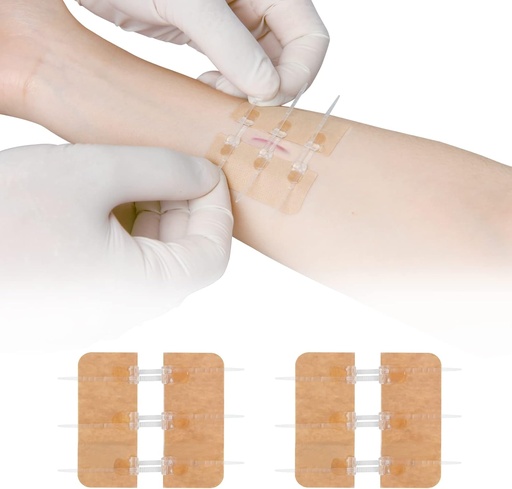 [BRSRMZT4OADRMGT7] Zip Stitch Laceration Repair Without Stitches Butterfly Bandaids Quick Clot - Emergency Wound Closures Device 2 Pieces（PU）