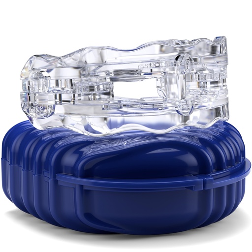 [BRSRMAYYBACQIHL4] Itus Mouthguardz: SilentZPro 2.0 - USA Designed & FDA-Cleared Anti Snore Mouthpiece - Fully Adjustable Anti Snore Mouth Guard - Professional Patented Anti Snore Device, Large