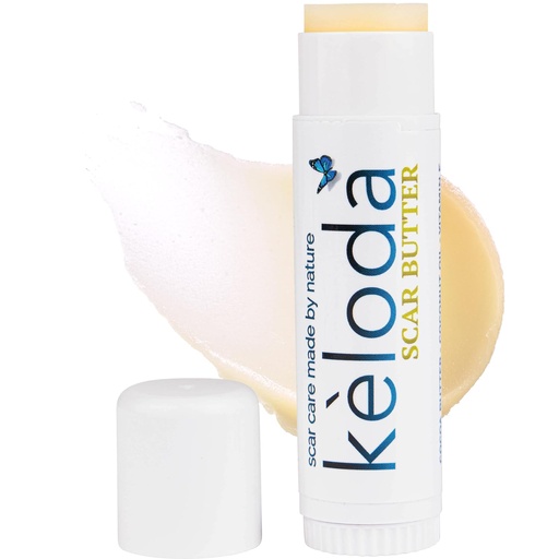 [BRSWGFAPB4GR4YDK] Keloid Scar Care Butter Stick, Scars & Keloids Treatment Balm, For Surgical Scars & Keloids from Piercings, Stretch Marks, Acne, With Anti-Scar Cocoa, Shea Butter, Coconut, & Jojoba Oils
