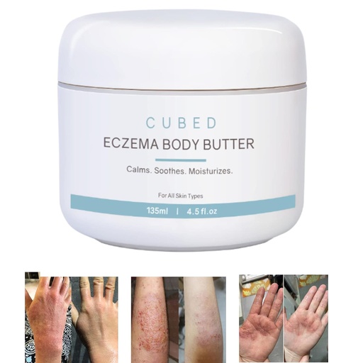[BRSRMCA2BMGWM3DJ] Cubed 4.5 oz Eczema Cream for Adults, Eczema Relief, Eczema Treatment, Moisturize Dry Irridated Skin, Smart Lotion for Topical Steroid Withdrawal Symptoms, Psoriasis & Rosacea, Eczema, Dermatitis