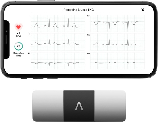 [BRSWGAAYCR7QOHIY] AliveCor KardiaMobile 6-juhtiv isiklik EKG Monitor – kuus südamevaadet – tuvastab AFibi ja ebaregulaarsed rütmihäired – kiired tulemused 30 sekundiga – töötab enamiku nutitelefonidega