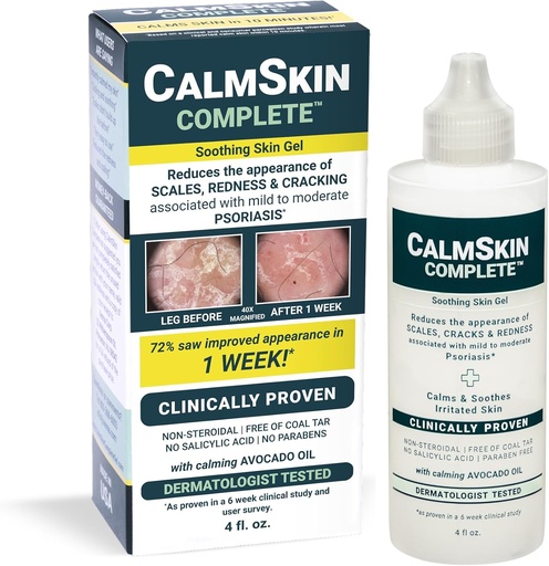 [BRSW2CQDPMHQKAA3] Xenna CalmSkin Complete () Clinicamente provado para acalmar a pele irritada e melhorar a aparência da pele com Psoríase leve a moderada () Made in The USA () 4 fl. oz.