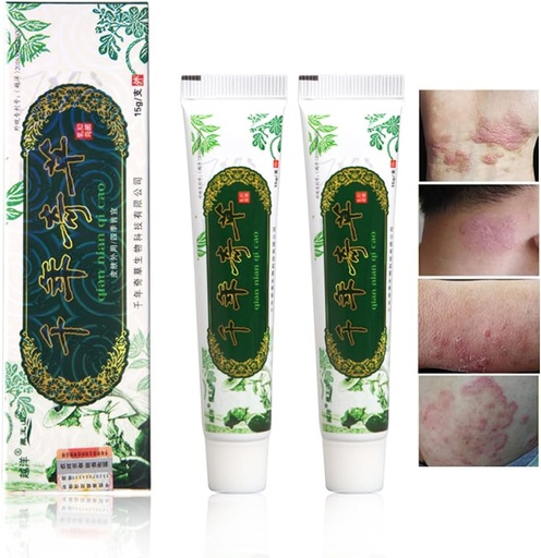 [BRSROGAZDMBBA2QY] Oversea Duizend-jaar kruiden crème Chinese kruiden eczeem, psoriasis crèmes dermatitis en eczeem Pruritus psoriasis JIULIN zalf (2PCS)